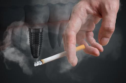 Dental Implant and Smoking